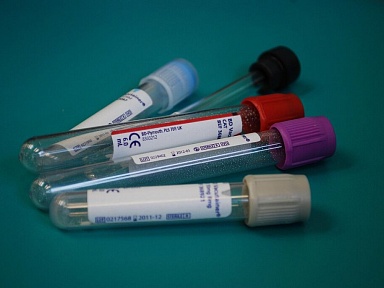 Rak jelita grubego przez lata nie boli. Darmowy test ratuje życie, a Polacy nie chcą go wykonywać